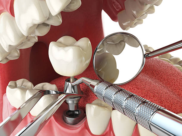Best Same-Day Emergency Dentist in Paincourtville, LA